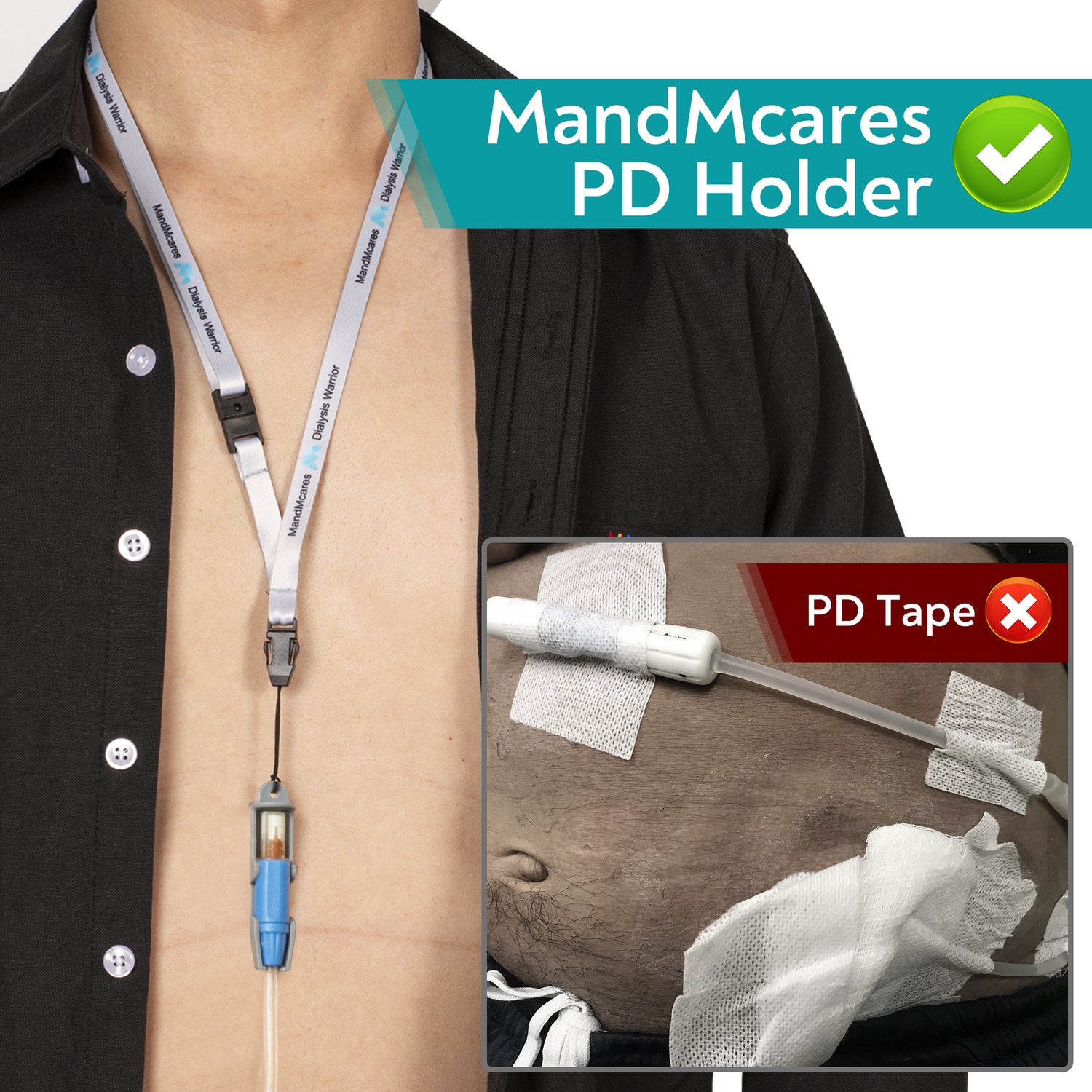 Small PD Transfer Set Holder  (1 Holder & 2 Adjustable Lanyards)