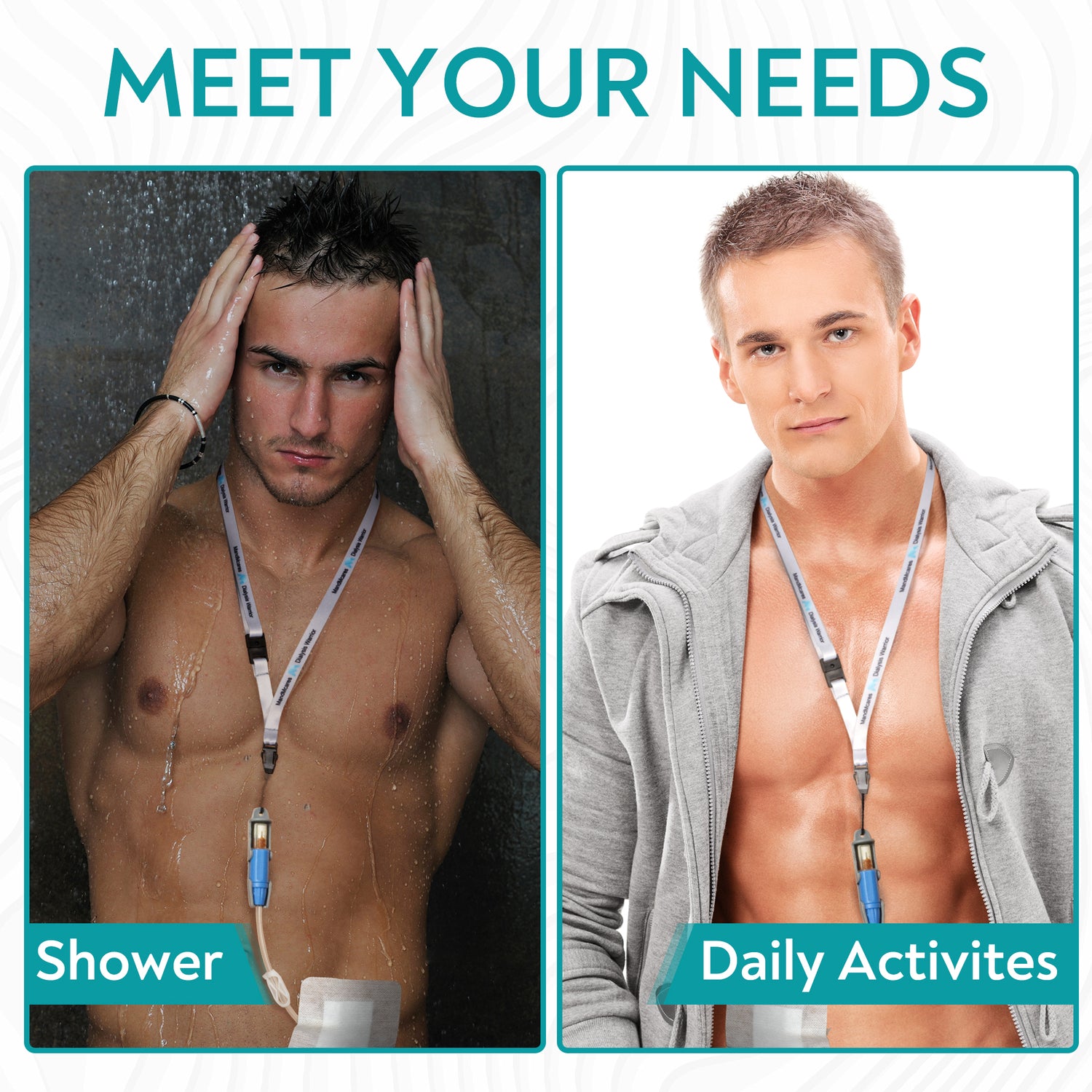 Small PD Transfer Set Holder  (1 Holder & 2 Adjustable Lanyards)