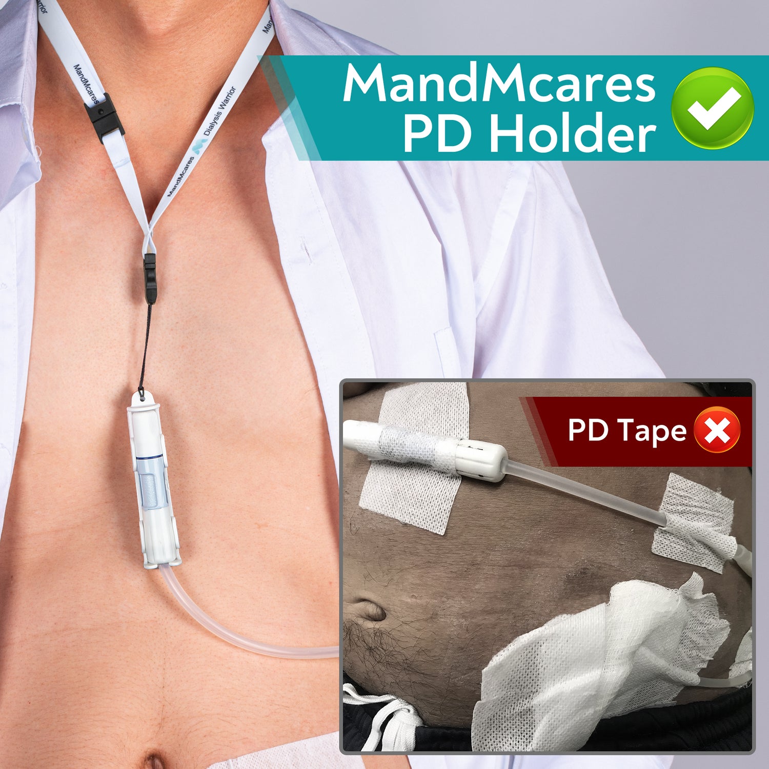 Baxter PD Holder (1 Holder & 2 Buckle Adjustable Lanyards w/ Breakaway Feature)