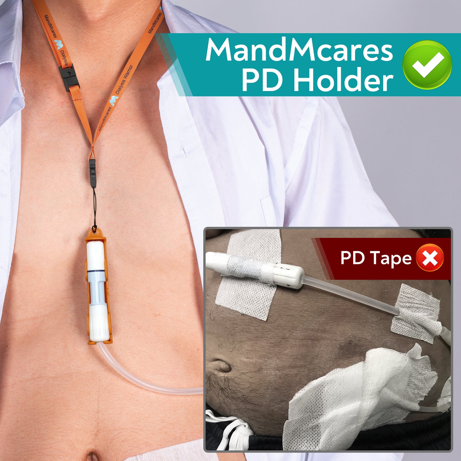 Baxter PD Holder (1 Holder & 2 Buckle Adjustable Lanyards w/ Breakaway Feature)