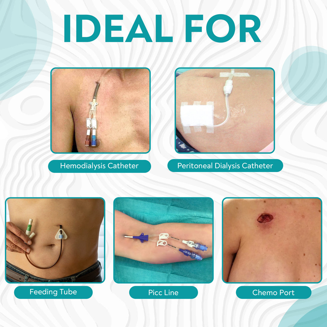 Shower Water Proof Dressing for Hemodialysis Peritoneal Dialysis Cathe MandMcares