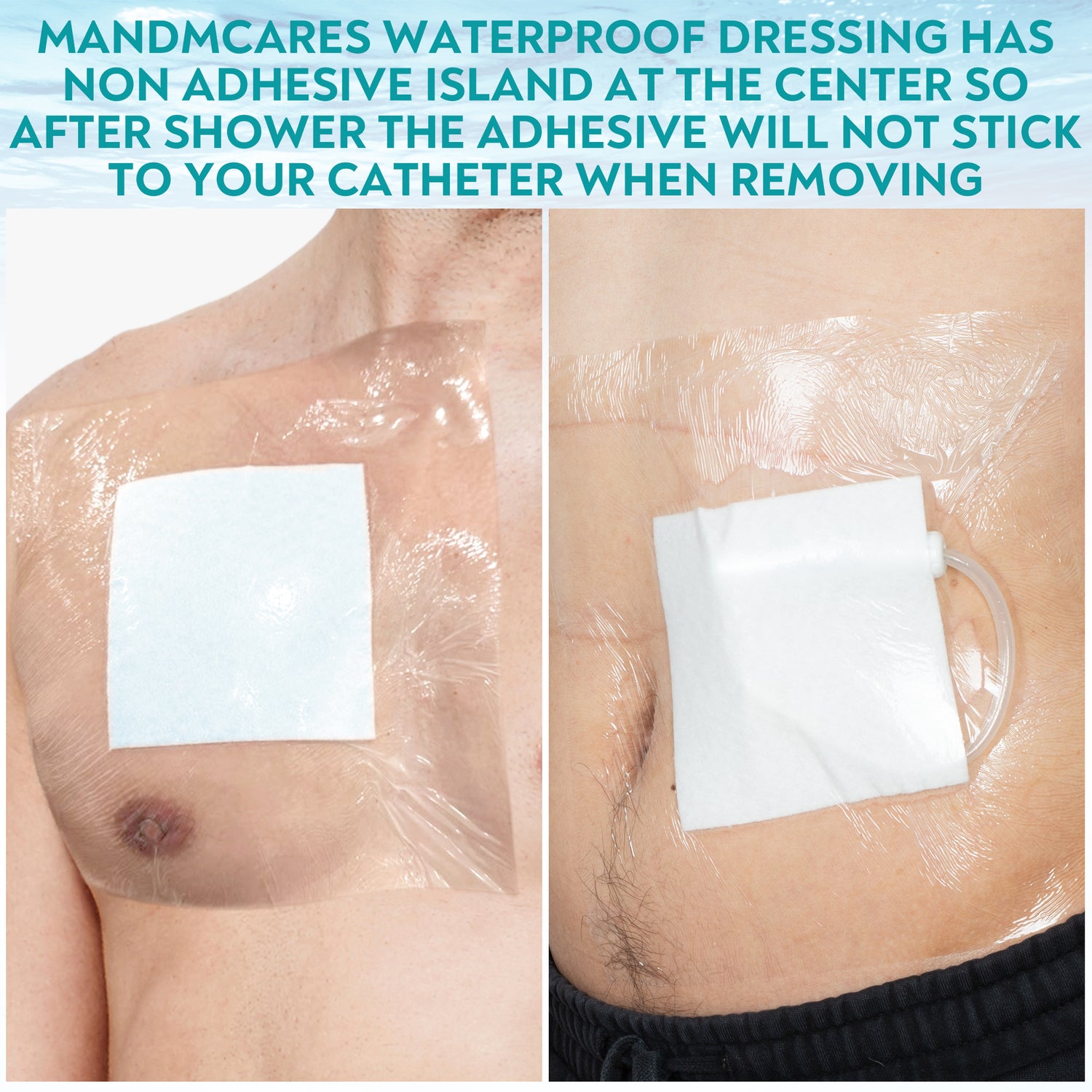 Water Proof Dressing for Hemodialysis Peritoneal Dialysis Catheter, Central Lines and Wounds  Shower Cover