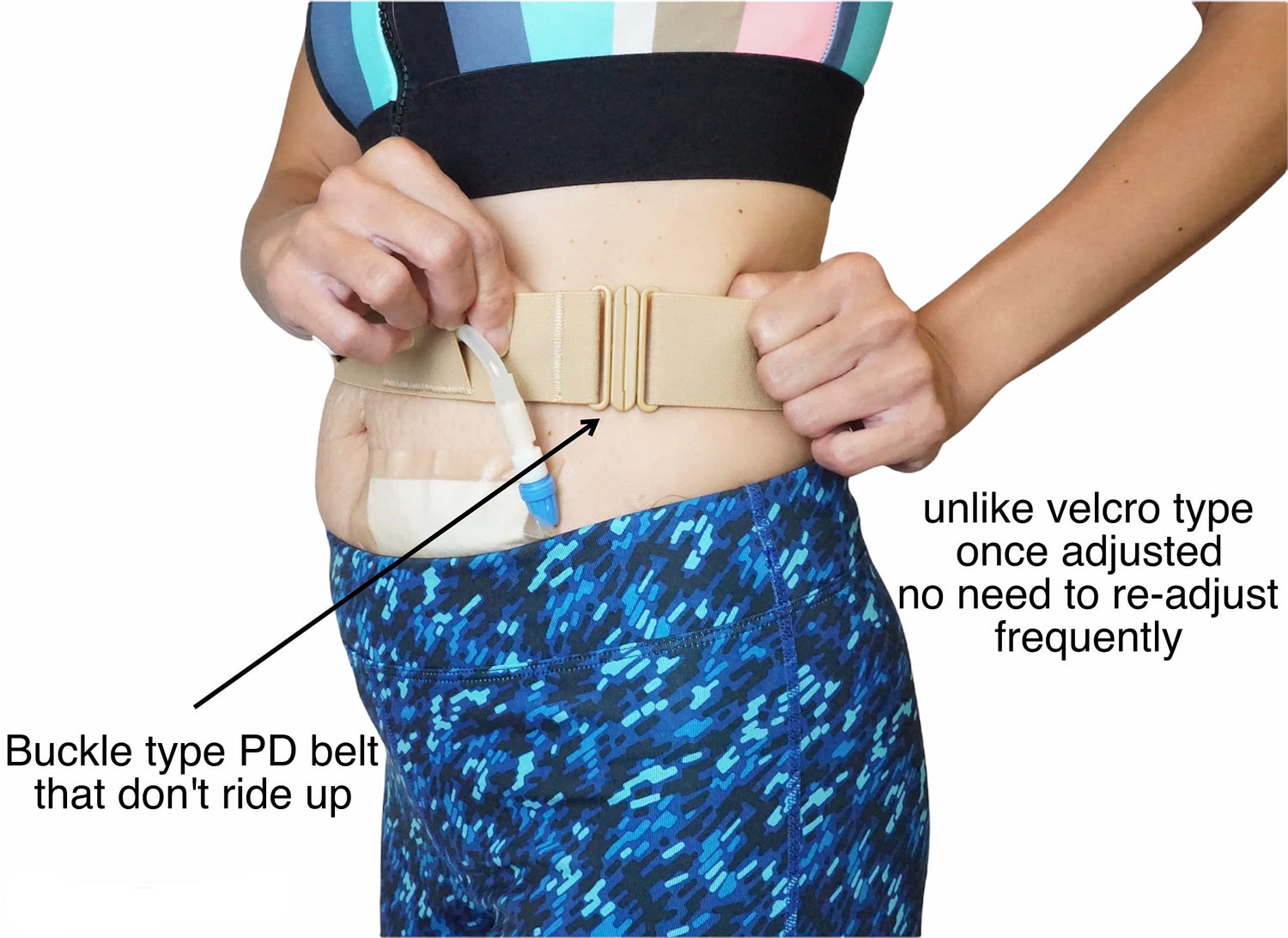 Peritoneal Dialysis Belt – Slim 1.5