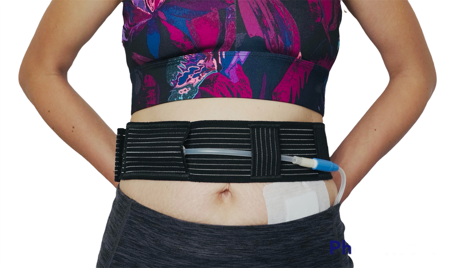 Velcro Type - Peritoneal Dialysis Belt