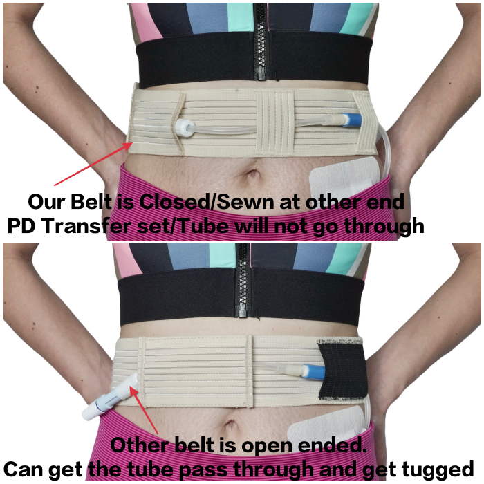 Velcro Type - Peritoneal Dialysis Belt