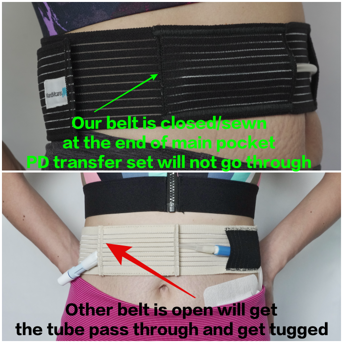 Velcro Type - Peritoneal Dialysis Belt